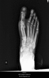 Figure 21