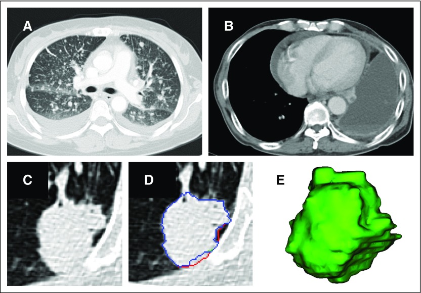 Fig 3.