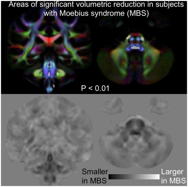 Graphical Abstract