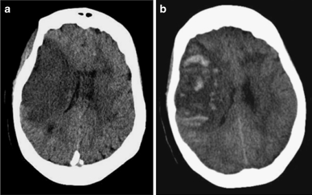 Fig. 1