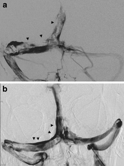 Fig. 4