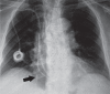 Fig. 11