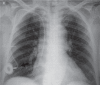Fig. 9