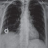 Fig. 14