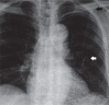 Fig. 16