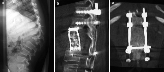 Fig. 3