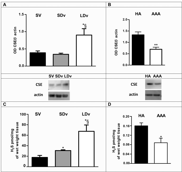 Reverse Regulatory Pathway (H2S / PGE2 / MMP) in Human Aortic Aneurysm ...