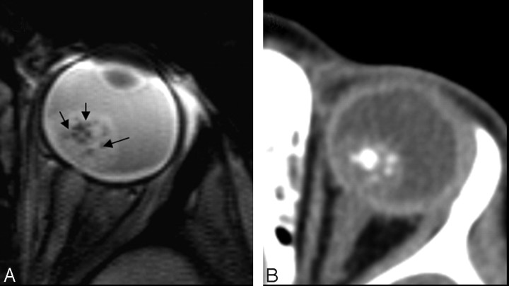 Fig 5.