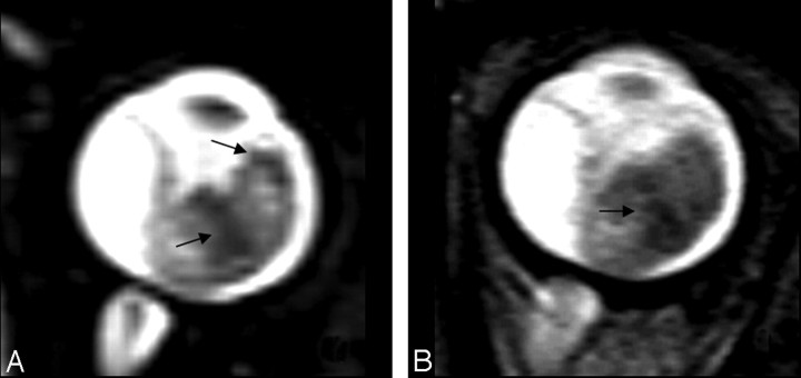 Fig 1.