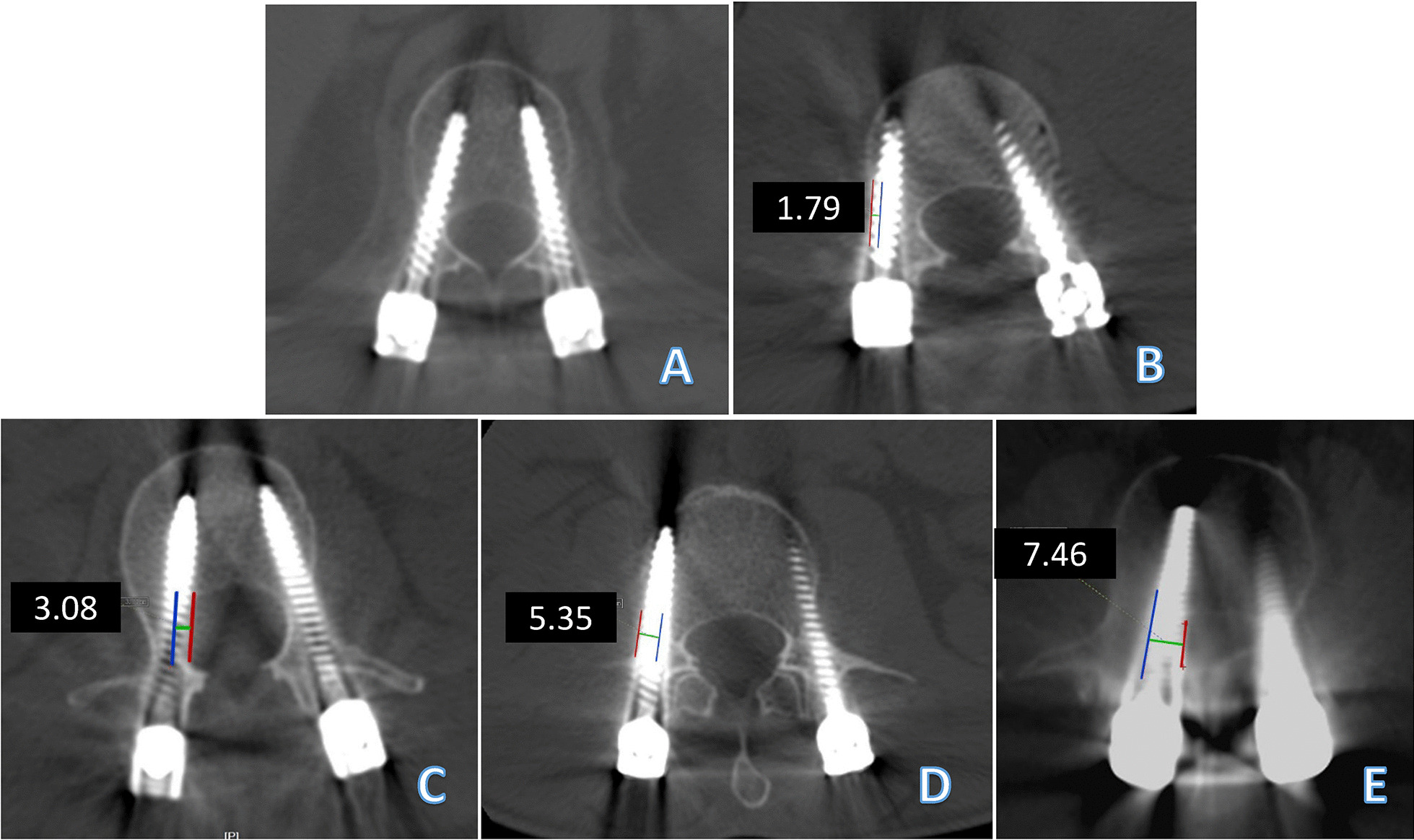 Fig. 3