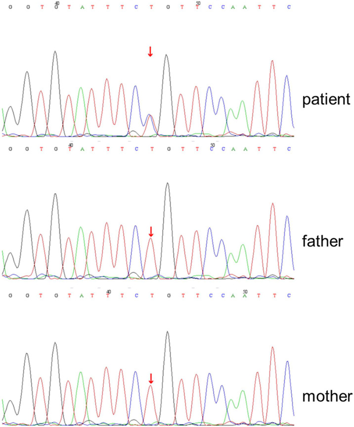 Figure 1