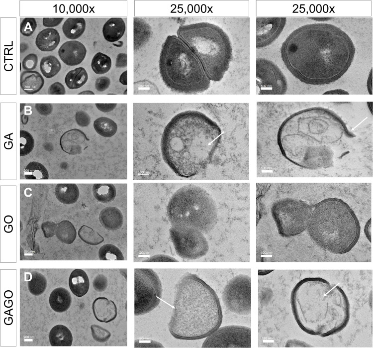 Figure 14