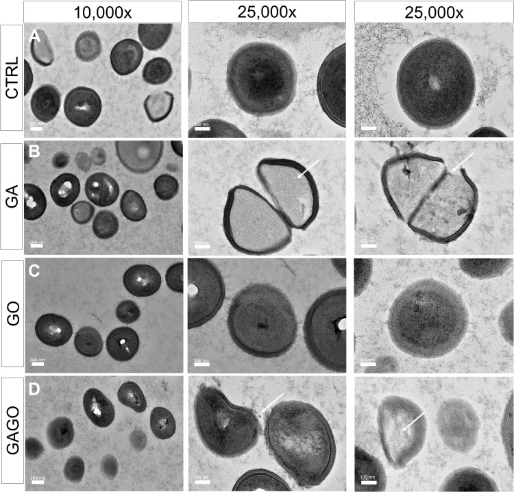 Figure 15