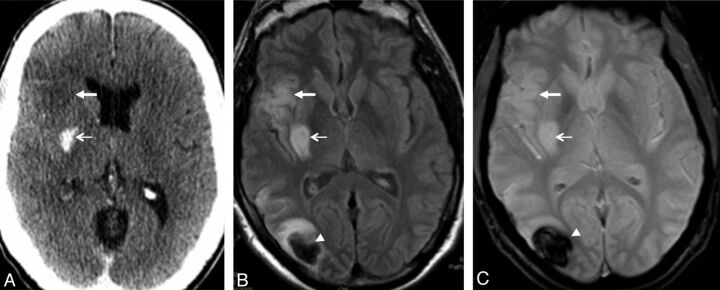 Fig 3.