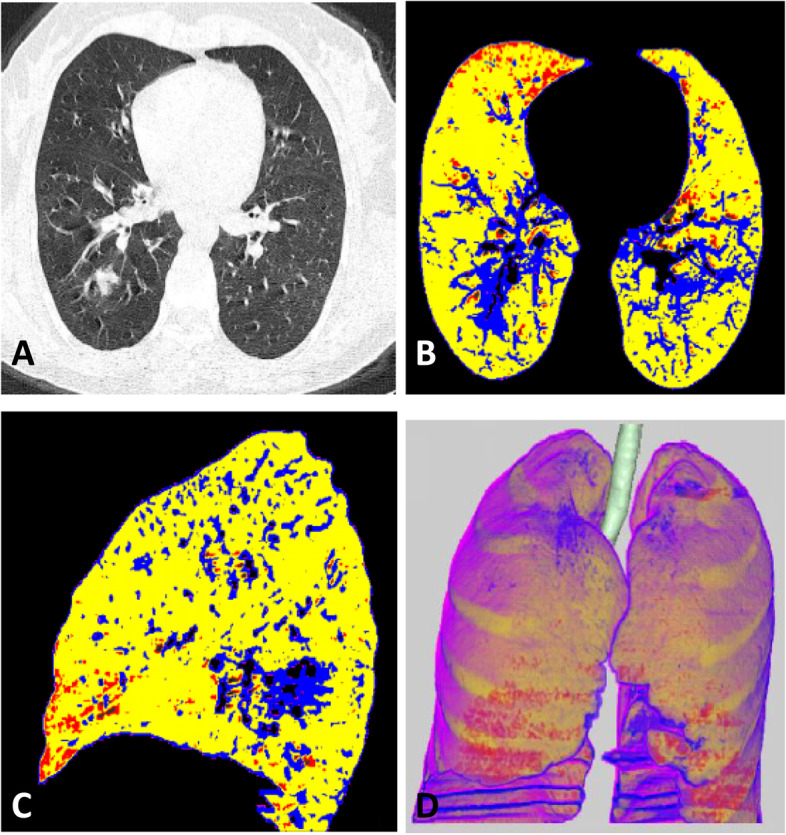 Fig. 2