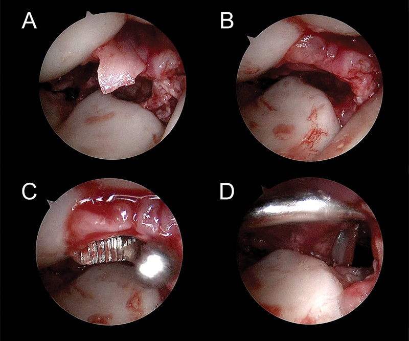 Fig. 23