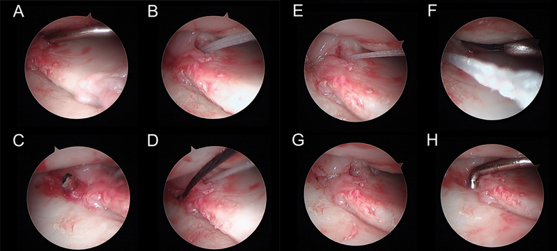 Fig. 36