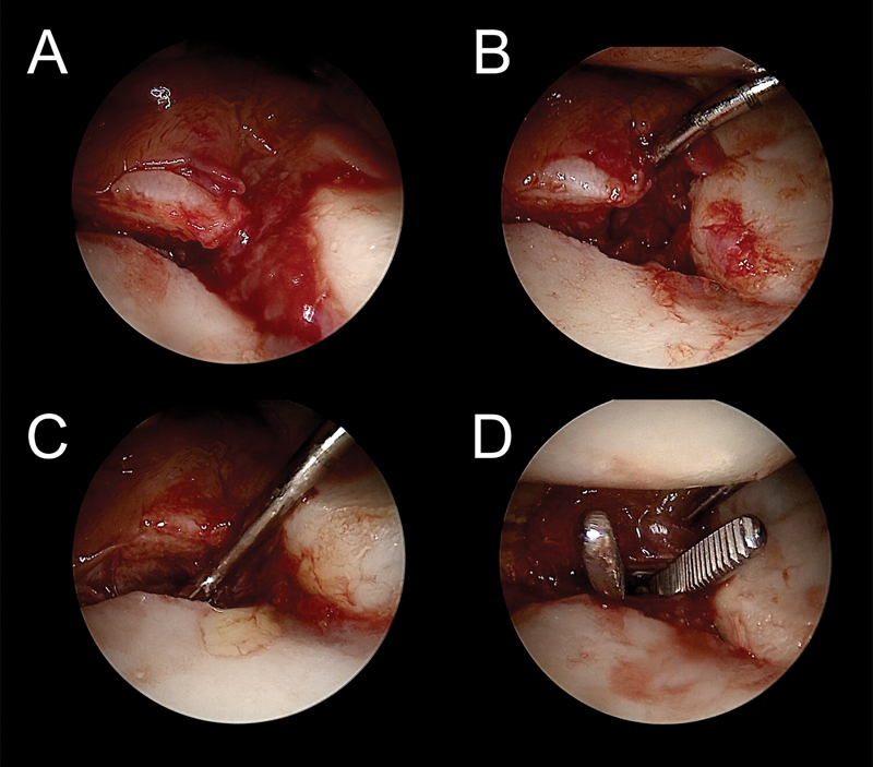 Fig. 10