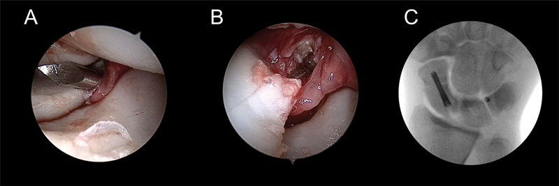 Fig. 31