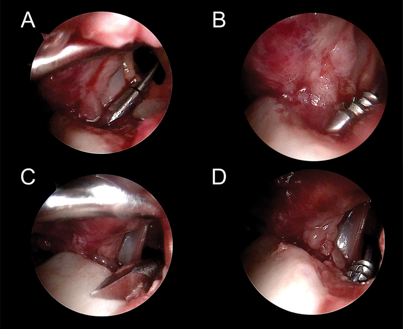 Fig. 24