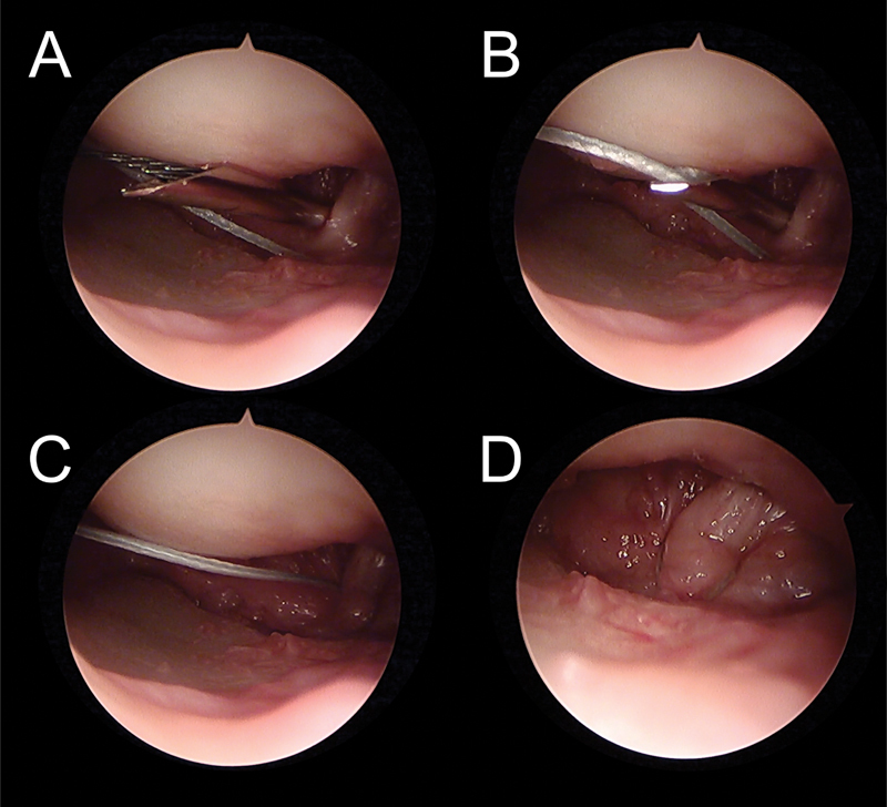 Fig. 18