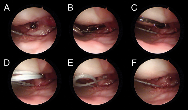 Fig. 17