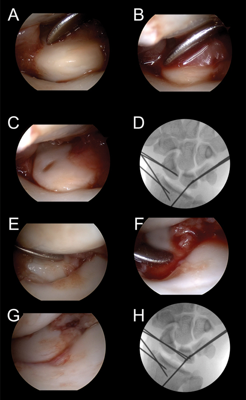 Fig. 22