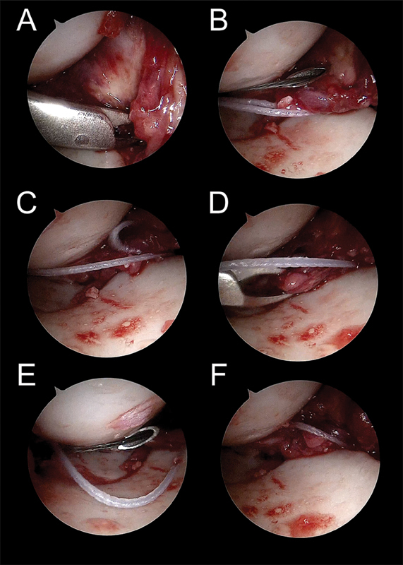 Fig. 27