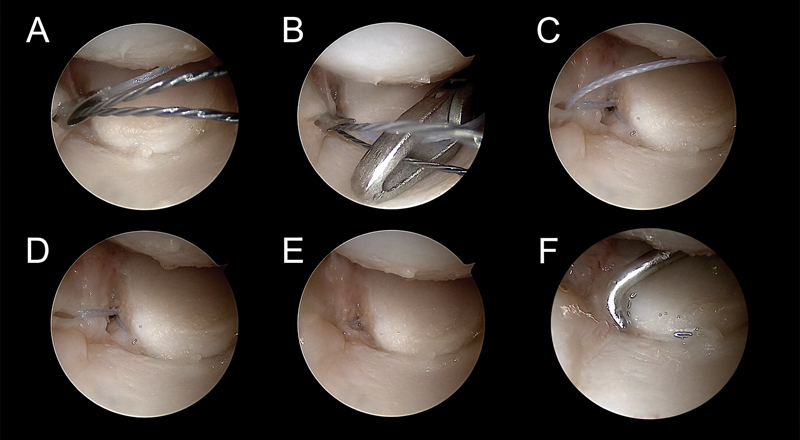 Fig. 9