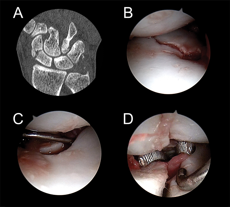 Fig. 30