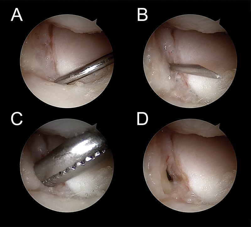 Fig. 5