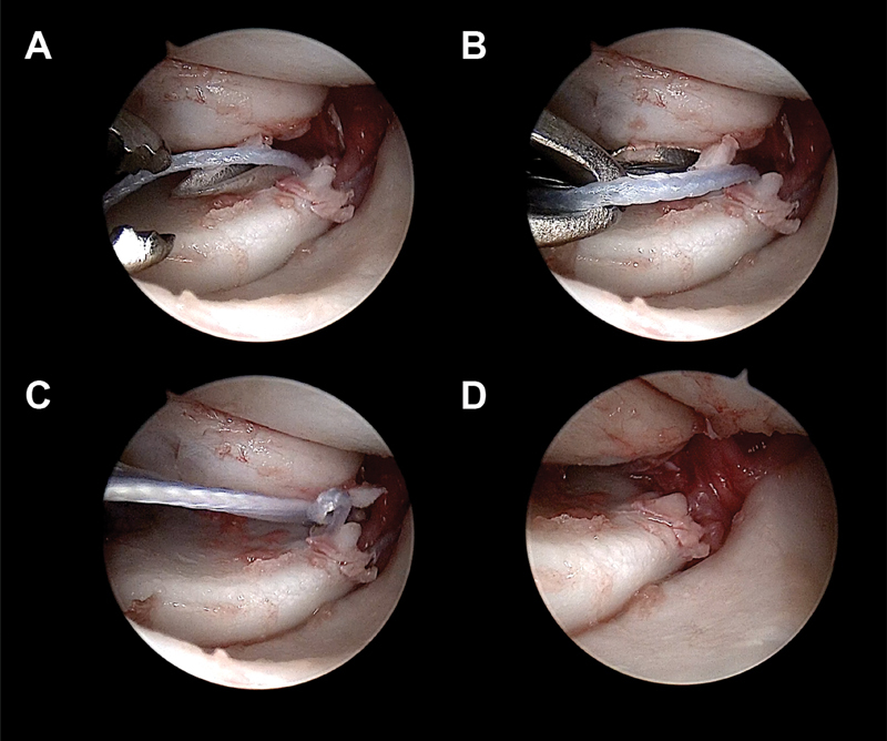 Fig. 33