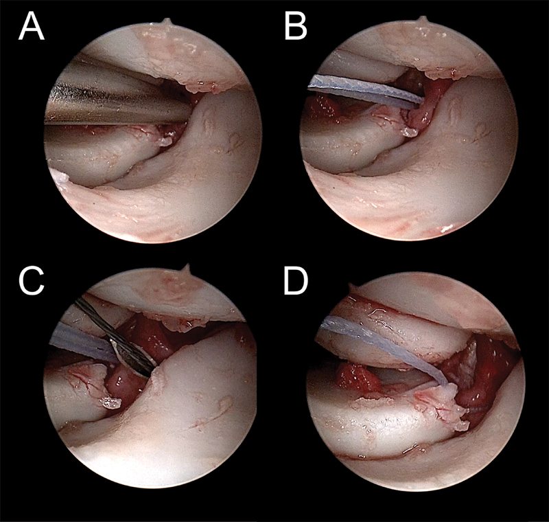 Fig. 32