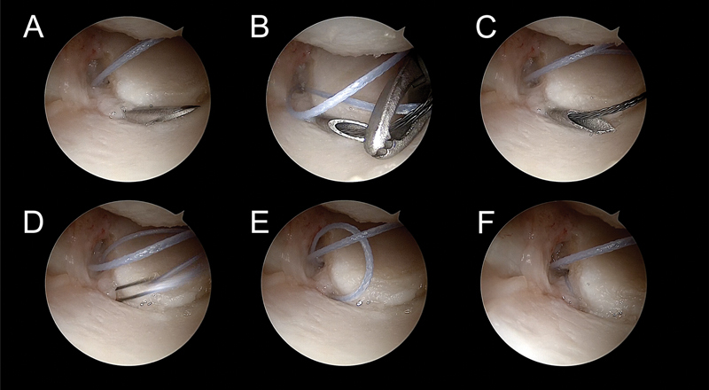 Fig. 8