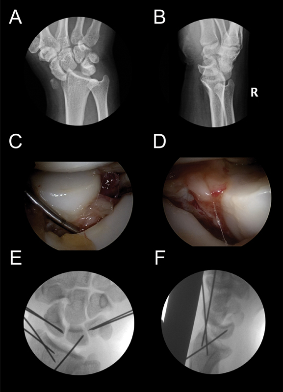 Fig. 21