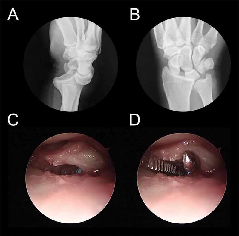 Fig. 15