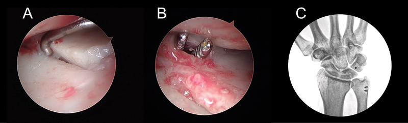 Fig. 35