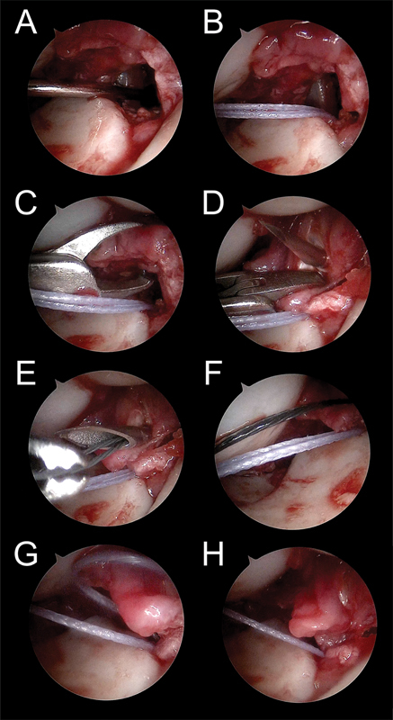 Fig. 25