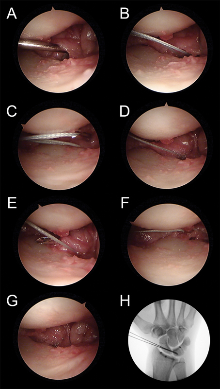 Fig. 19