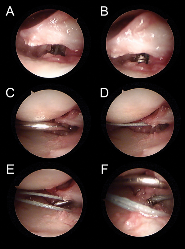 Fig. 16