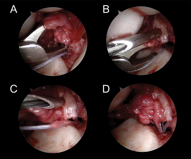 Fig. 26