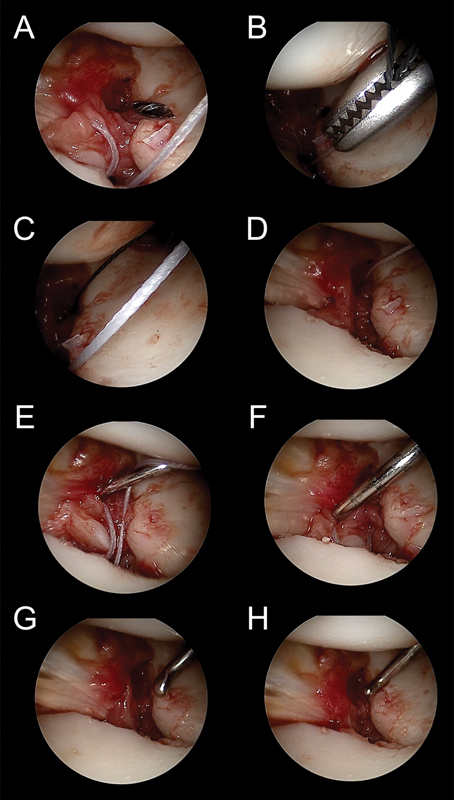 Fig. 14