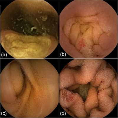 FIGURE 3