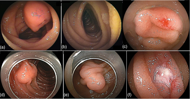 FIGURE 2