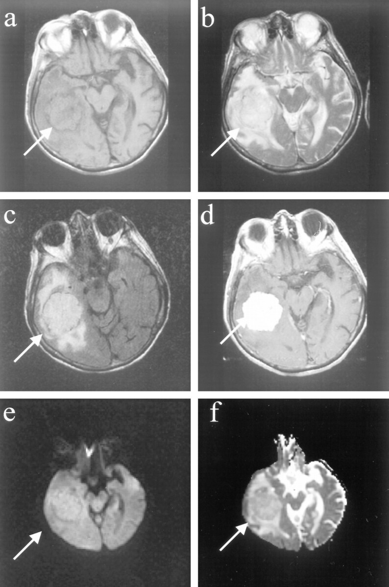 fig 2.