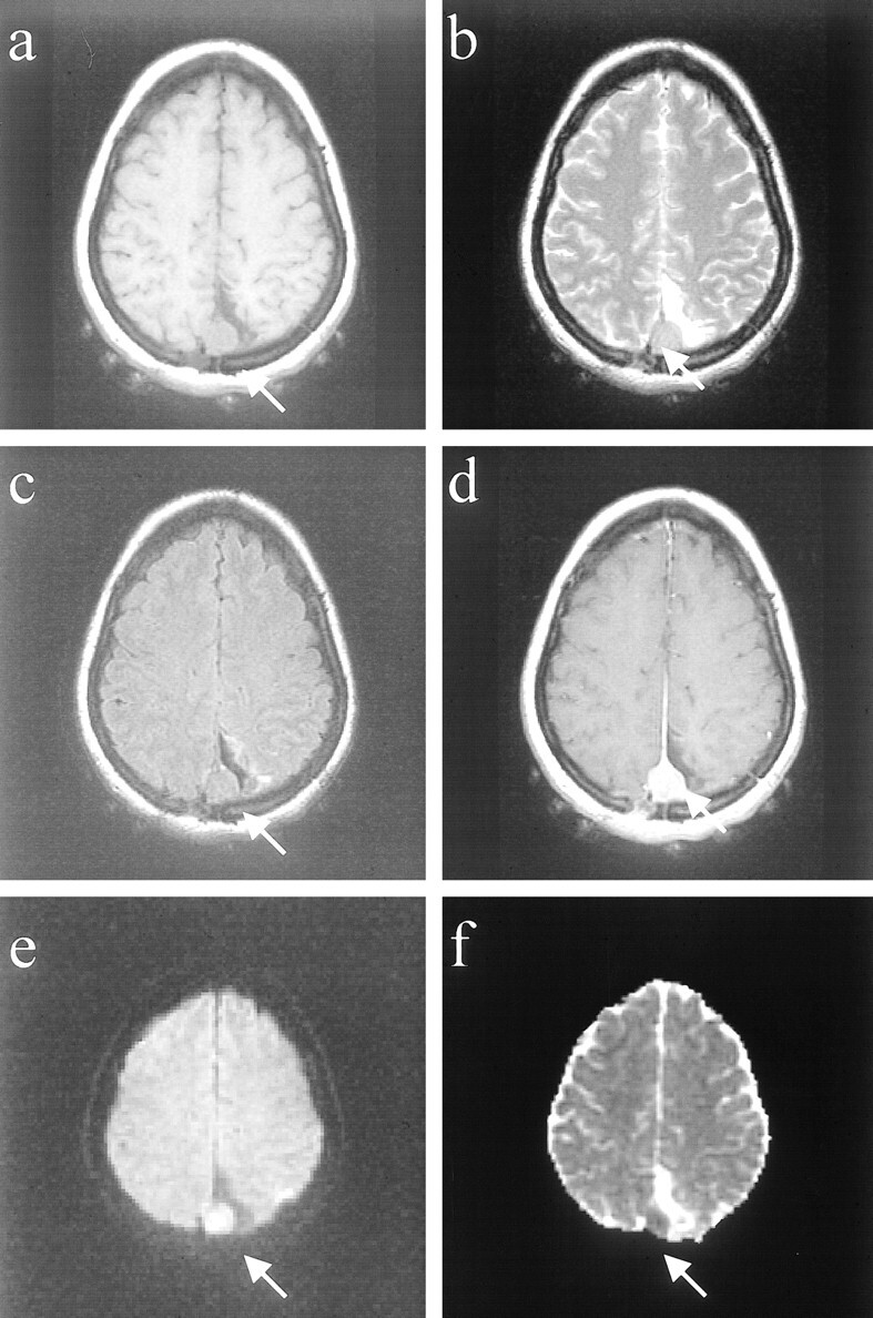 fig 1.