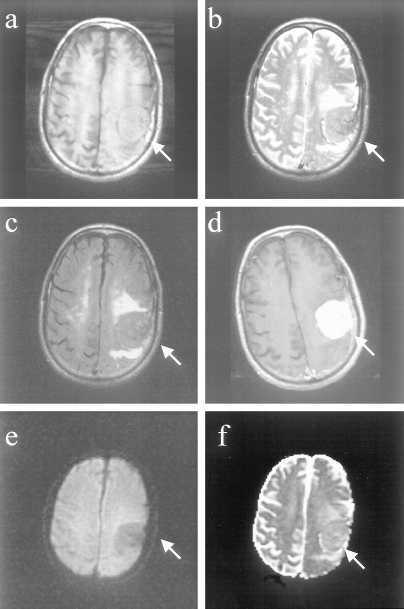 fig 3.