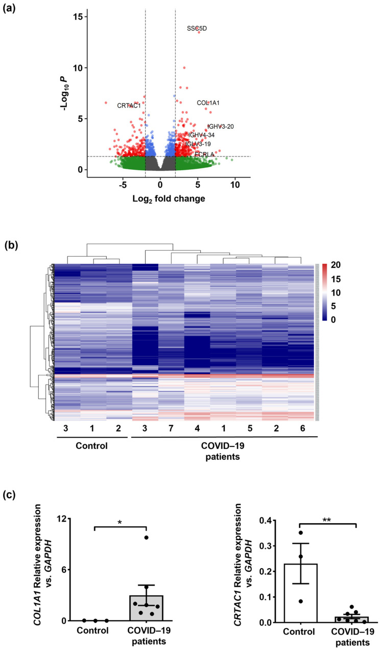 Transcriptional Insights Of Oxidative Stress And Extracellular Traps In 