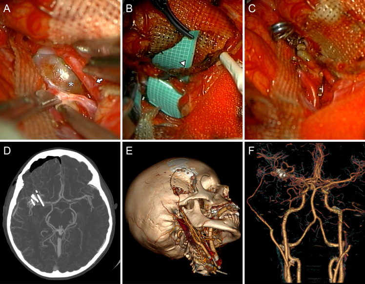 FIG. 4.