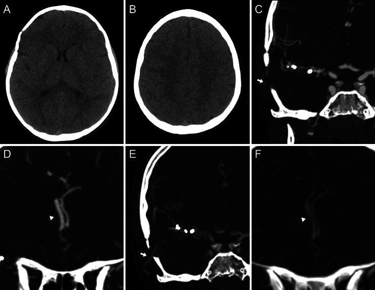 FIG. 5.